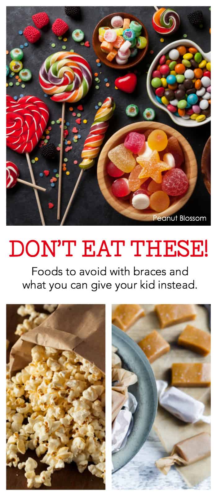 Don't eat these!: What can't you eat with braces | Hull & Coleman South Charlotte orthodontists