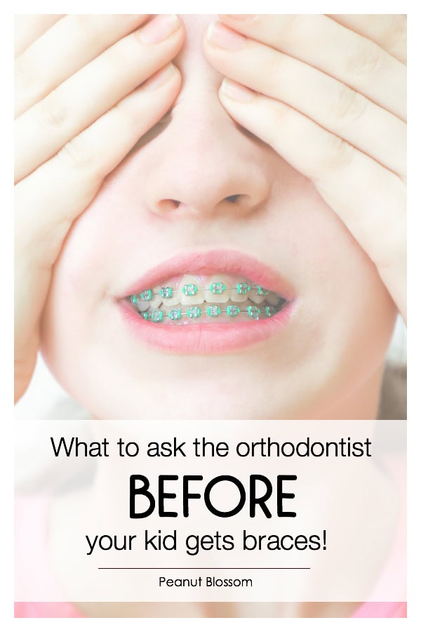 What to ask the best orthodontist in Charlotte, NC before your kids get braces