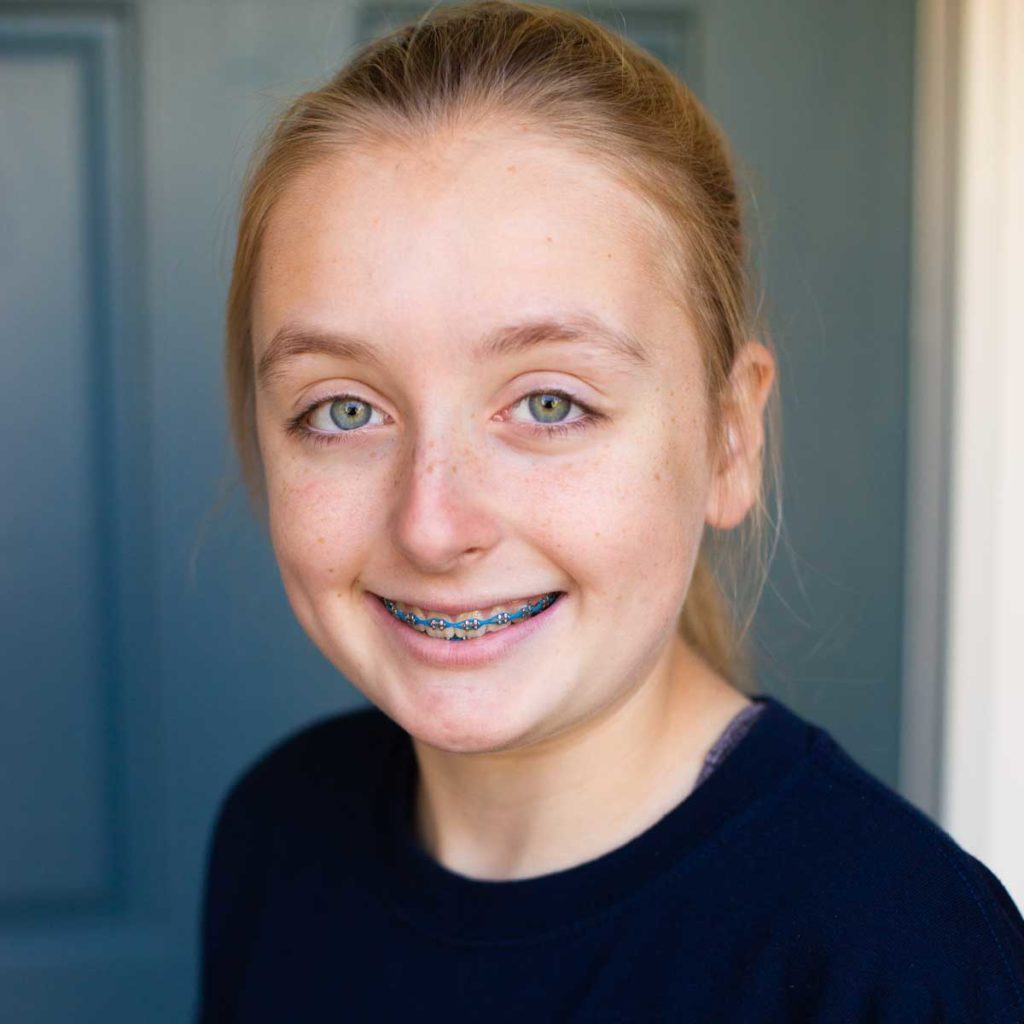 Everything Kids Need to Know About Getting Braces {VIDEO}