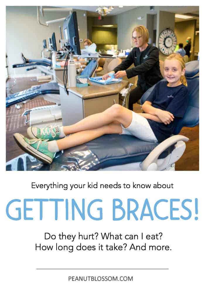 EVERYTHING your kid needs to know about getting braces: Do braces hurt? What can I eat with braces? and more! Kid-to-kid advice from a girl who is one year into orthodontic treatment.